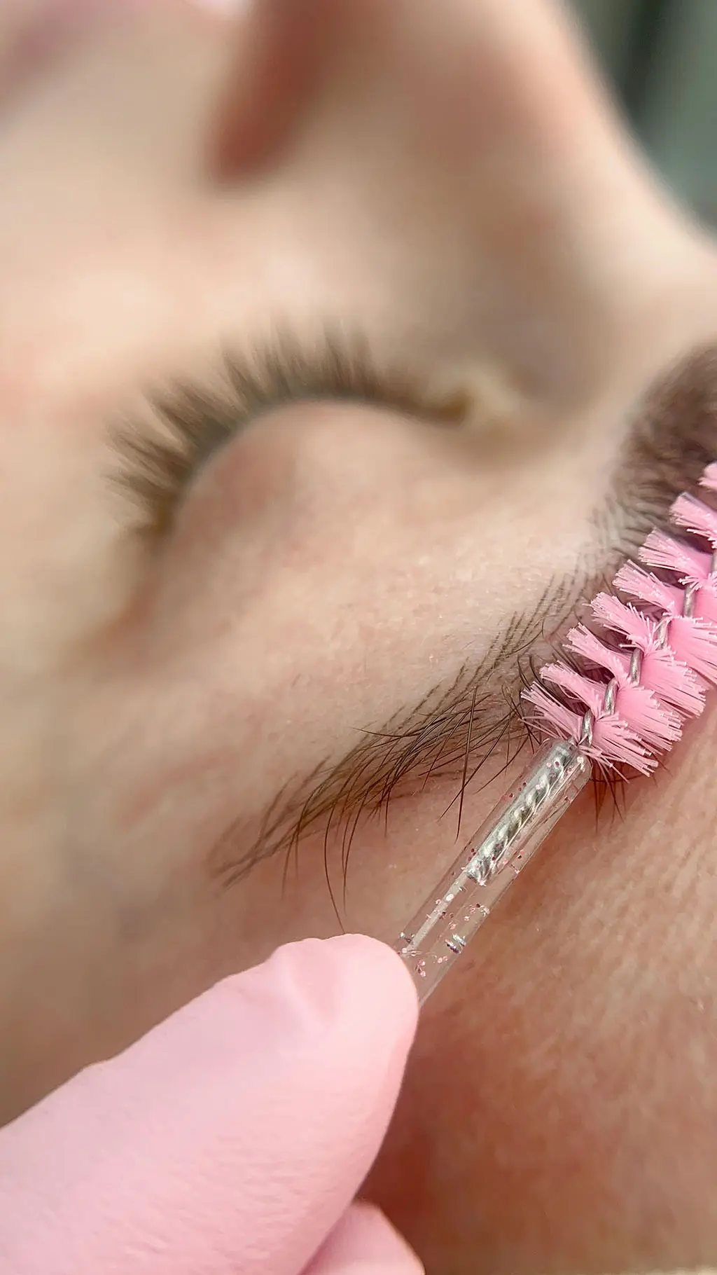 Transplante de sobrancelhas vira moda no Brasil